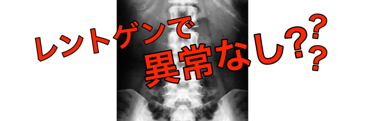 腰椎のレントゲン画像異常なし。