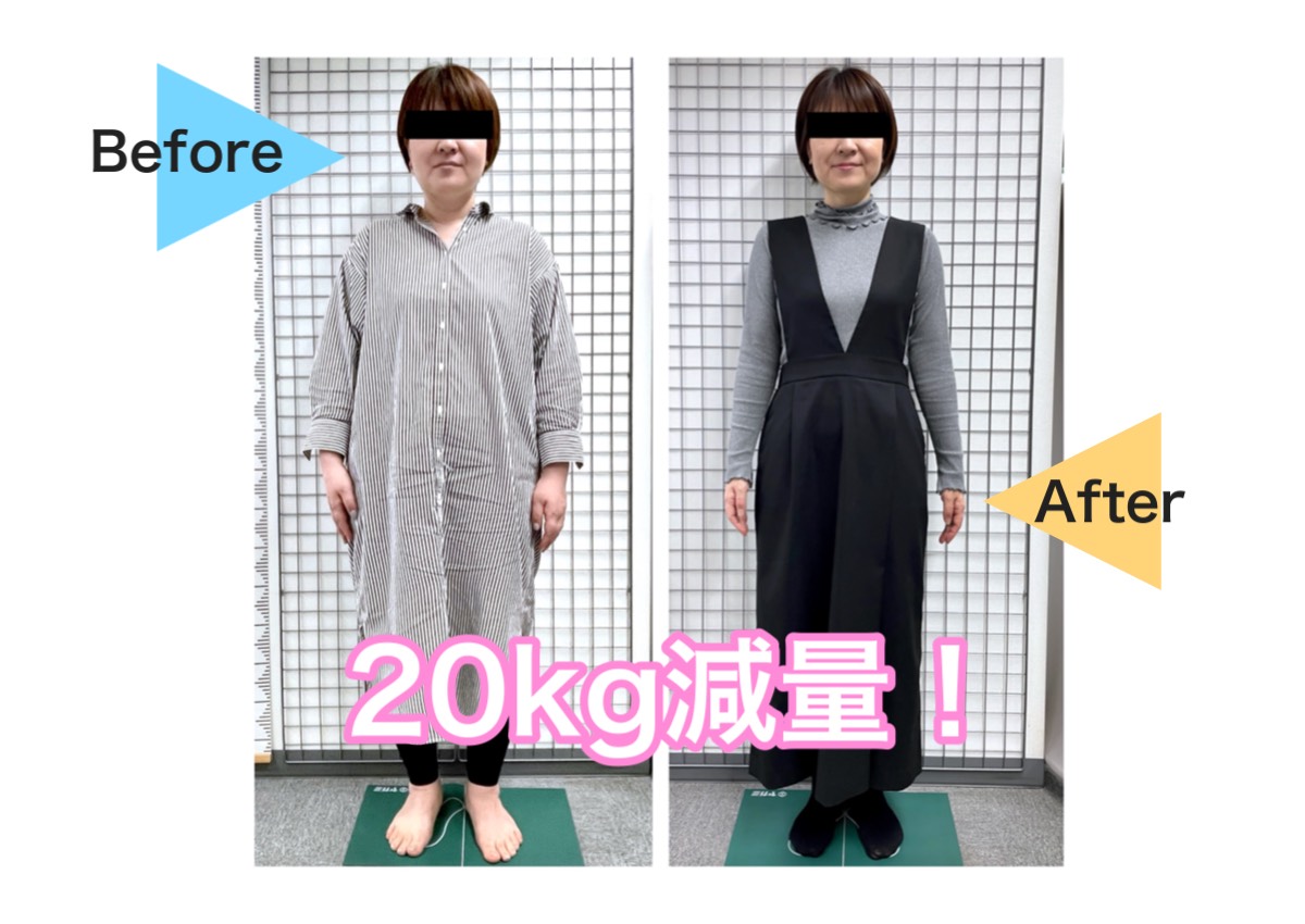 毒出し耳つぼダイエットで20kg減量